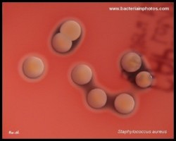 yellow pigmented S.aureus colonies on blood agar